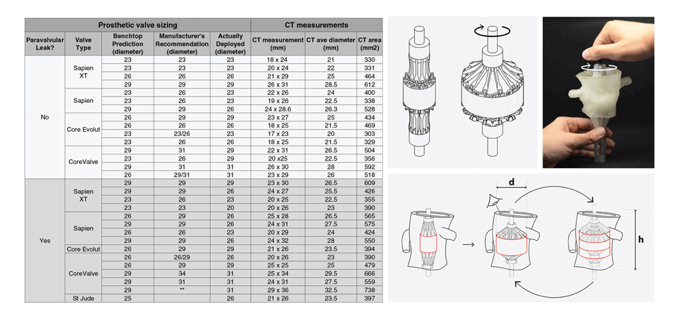 pre-procedural-fit-testing-transcatheter-aortic-valve-replacement-tavr-valves-using-parametric-modeling-3d-printing-7 pre-procedural-fit-testing-transcatheter-aortic-valve-replacement-tavr-valves-using-parametric-modeling-3d-printing-7